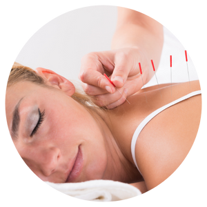 Kvinna får akupunktur med nålar i ryggen. Boka tid för akupunktur hos Ryggkliniken i Bromma